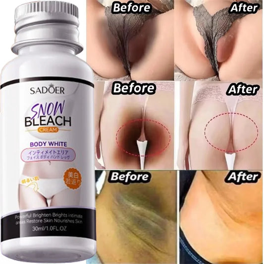 Whitening Cream Private Parts